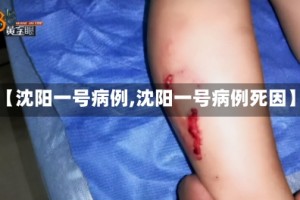【沈阳一号病例,沈阳一号病例死因】