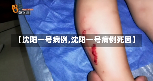 【沈阳一号病例,沈阳一号病例死因】-第1张图片