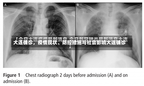 大连确诊	，疫情现状、防控措施与社会影响大连确诊-第2张图片