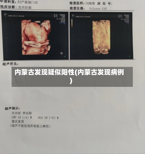 内蒙古发现疑似阳性(内蒙古发现病例)-第2张图片